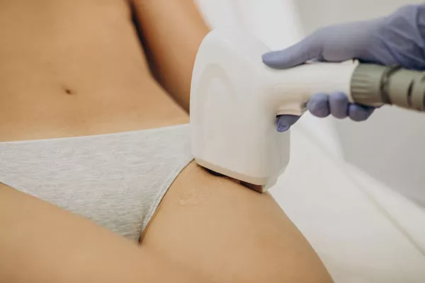 Épilation du maillot au laser : niveau de douleur et modalités, Alfortville, GLOW STUDIO
