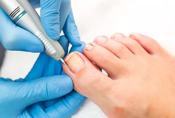 Extension sur un ongle de pied cassé, Alfortville, GLOW STUDIO